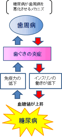 糖尿病が歯周病を悪化させるメカニズムの説明図